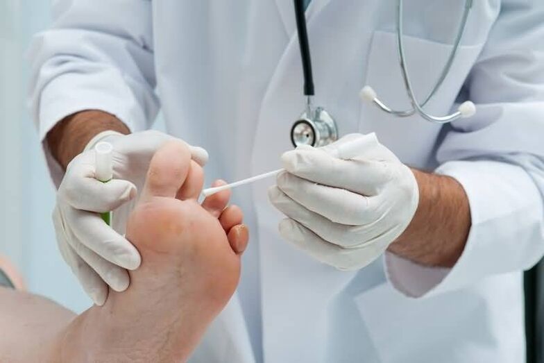 Dacă aveți simptome de ciupercă a unghiilor de la picioare, ar trebui să consultați un dermatolog sau un micolog. 